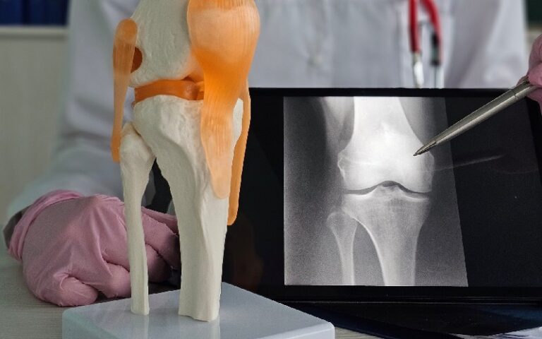 Dr-Samarth-blog-2-image-2